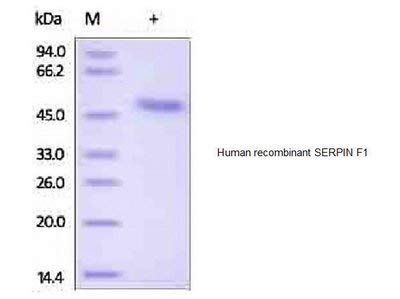 7418-50-Dimensiune: 50 micrograme-CellExp uman SERPIN F1, recombinant uman-fiecare